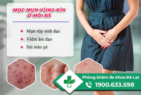 Hình ảnh minh họa